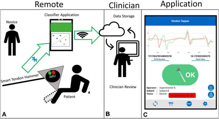 An intelligent hammer for remote examination of the tendon reflex